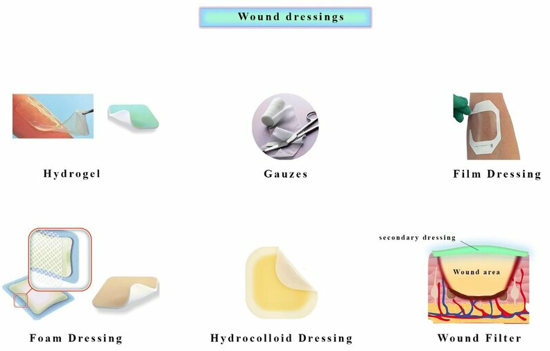 Types of wound dressing